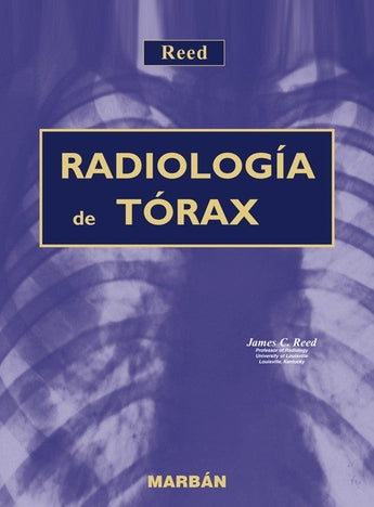 Radiología de Tórax - Premium ISBN: 9788471014688 Marban Libros