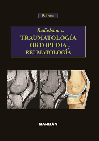 Radiología en Traumatología, Ortopedia y Reumatología ISBN: 9788471016195 Marban Libros