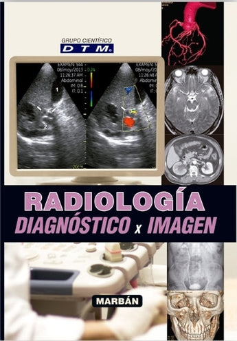 Radiología Esencial SERAM (incluye eBook + regalo DTM Radiología) ISBN: 9788491103493 Marban Libros