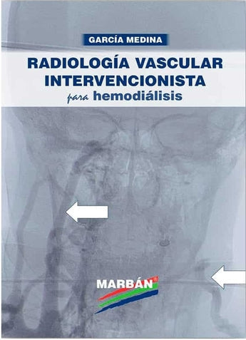 Radiología vascular intervencionista para hemodiálisis ISBN: 9788417184971 Marban Libros