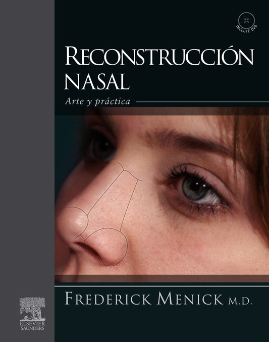 Reconstrucción Nasal ISBN: 9788480866934 Marban Libros