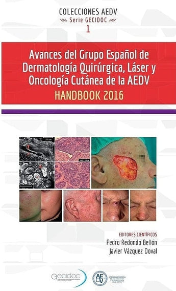Redondo . Vázquez - Avances del Grupo Español de Dermatología Quirúrgica, Láser y Oncología Cutánea de la AEDV ISBN: 9788478856114 Marban Libros