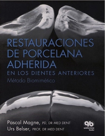 Restauraciones de Porcelana Adherida en los Dientes Anteriores. Método Biomimético ISBN: 9788489873285 Marban Libros