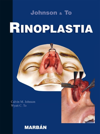 Rinoplastia ISBN: 9788471016065 Marban Libros
