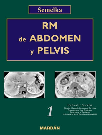 RM de Abdomen y Pelvis, 2 Vols ISBN: 9788471014254 Marban Libros
