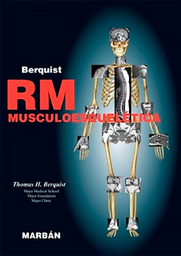 RM Musculoesquelética