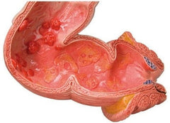SKU: K285 - MODELO INTESTINO GRUESO PATOLÓGICO ISBN: K285 Marban Libros