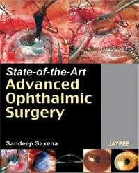 State of the Art Advanced Ophthalmic Surgery ISBN: 9788184481884 Marban Libros