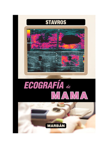 Ecografía de Mama