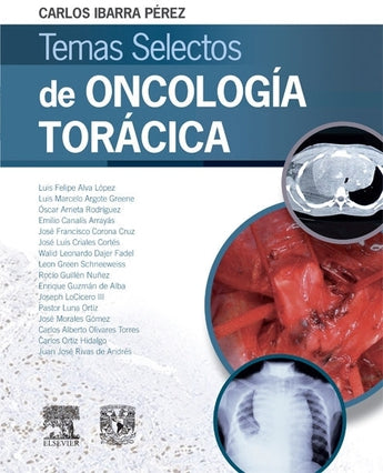 Temas selectos de oncología torácica ISBN: 9788490229439 Marban Libros