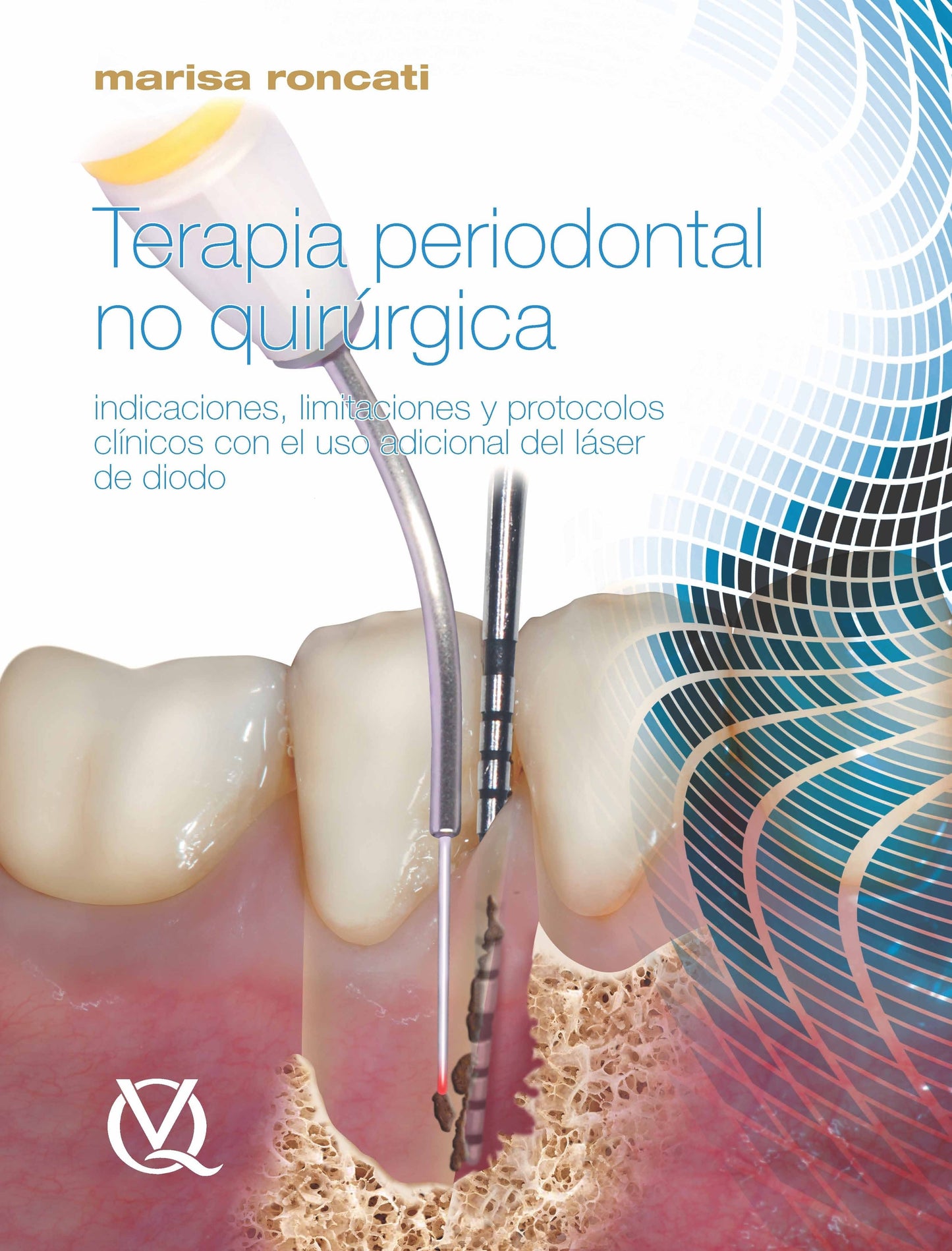 Terapia Periodontal no Quirúrgica ISBN: 9788489873681 Marban Libros