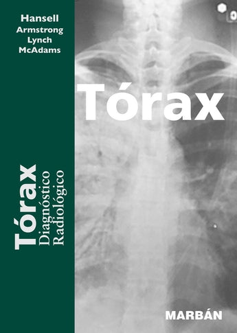 Tórax Diagnóstico Radiológico ISBN: 9788471015102 Marban Libros