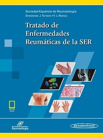 Tratado de Enfermedades Reumáticas de la SER ISBN: 9788491102816 Marban Libros