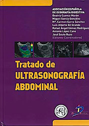 Tratado de ultrasonografía abdominal