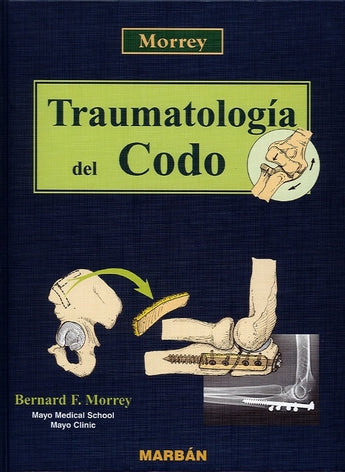 Traumatología del Codo ISBN: 9788471014207 Marban Libros