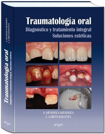 Traumatología oral Diagnóstico y tratamiento integral soluciones estéticas ISBN: 9788484739814 Marban Libros