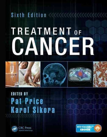 Treatment of Cancer ISBN: 9781482214949 Marban Libros