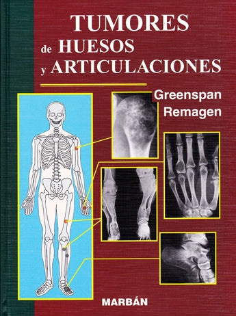 Tumores de huesos y articulaciones ISBN: 9788471013637 Marban Libros