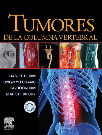 Tumores de la Columna Vertebral ISBN: 9788480866408 Marban Libros