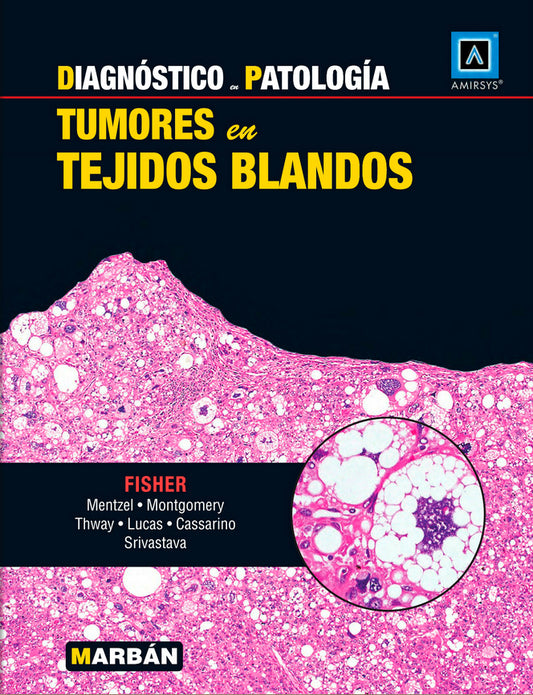 Diagnóstico en Patología - Tumores en tejidos blandos