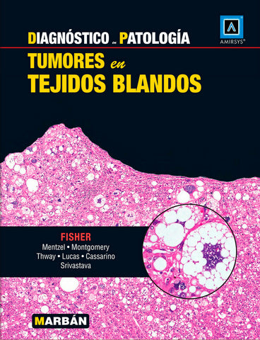 Diagnóstico en Patología - Tumores en tejidos blandos - Amirsys