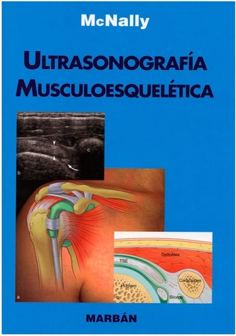 Ultrasonografía Musculoesquelética ISBN: 9788471016300 Marban Libros