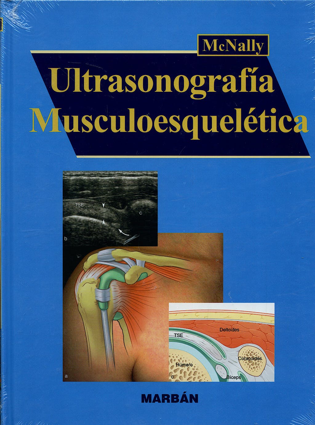 Ultrasonigrafía Musculoesquelética