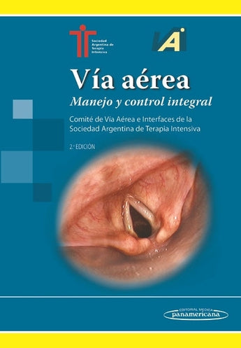 Vía Aérea. Manejo y Control Integral ISBN: 9789500694964 Marban Libros