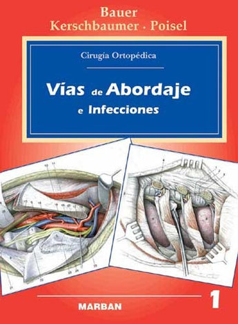 Vías de Abordaje e Infecciones. Cirugía Ortopédica. Vol 1 ISBN: 9788471012324 Marban Libros