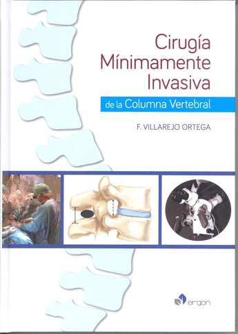 Villarejo Ortega - Cirugía Mínimamente Invasiva de la Columna Vertebral ISBN: 9788416270651 Marban Libros