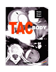 TAC Body