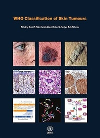 WHO Classification of Skin Tumours ISBN: 9789283224402 Marban Libros