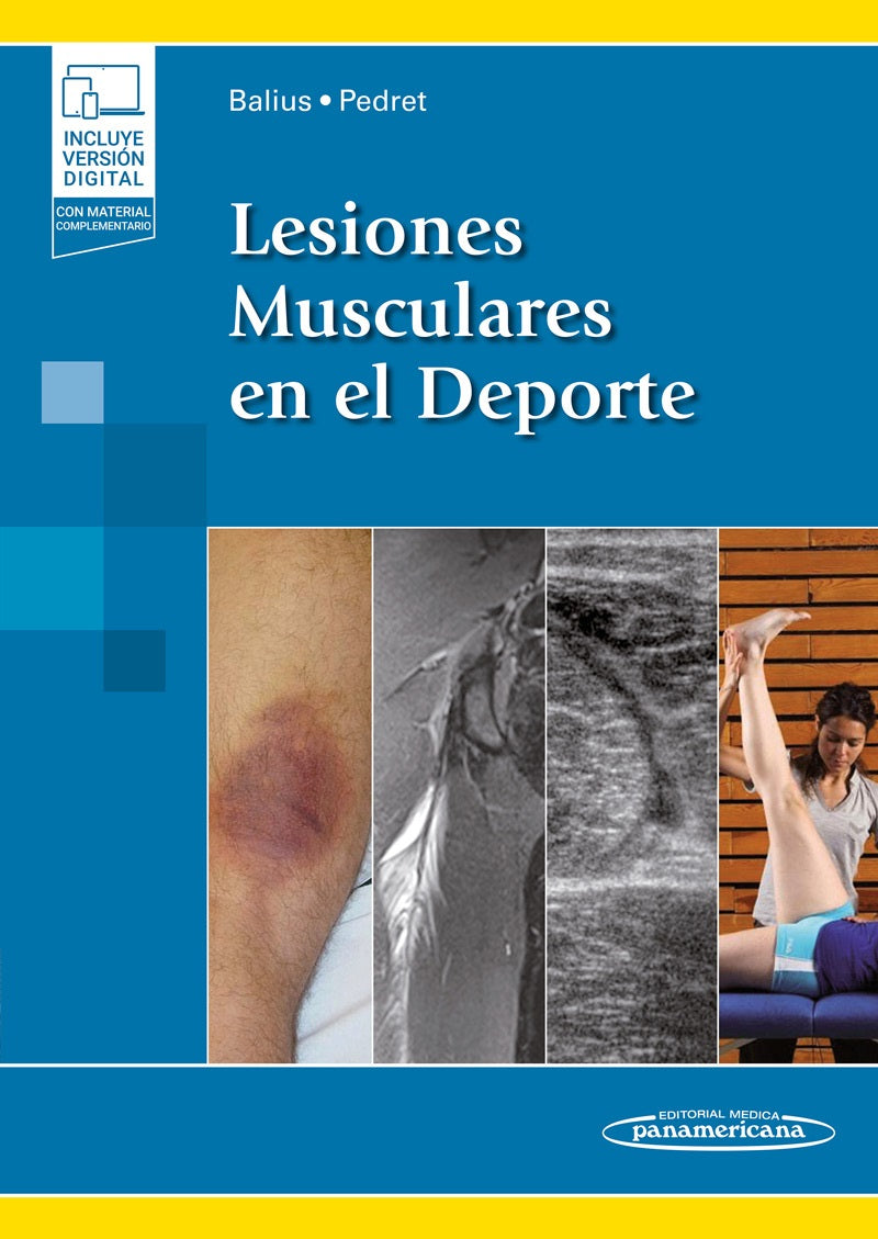 Lesiones Musculares en el Deporte