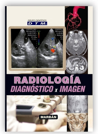 XRadiología Diagnóstico x Imagen ISBN: 9788416042227 Marban Libros